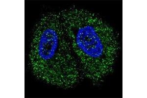 Fluorescent confocal image of MCF7 cells stained with PKM2 antibody. (PKM2 antibody  (AA 476-505))