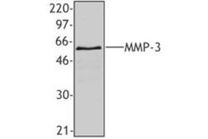 Image no. 1 for anti-Matrix Metallopeptidase 3 (Stromelysin 1, Progelatinase) (MMP3) antibody (ABIN205498) (MMP3 antibody)