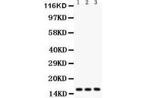 Anti-Survivin antibody, Western blotting All lanes: Anti Survivin  at 0. (Survivin antibody  (AA 1-140))