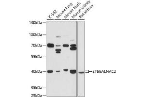 Western blot analysis of extracts of various cell lines, using ST6G antibody (ABIN7270579) at 1:1000 dilution. (ST6GALNAC2 antibody  (AA 30-200))