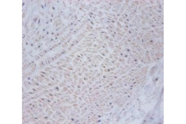 CSRP2 antibody  (AA 2-193)