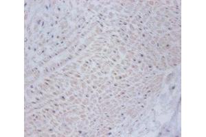 Immunohistochemistry of paraffin-embedded human umbilical cord tissue using ABIN7149009 at dilution of 1:100 (CSRP2 antibody  (AA 2-193))