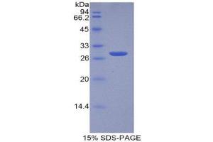SDS-PAGE (SDS) image for Tumor Protein, Translationally-Controlled 1 (TPT1) (AA 1-172) protein (His tag) (ABIN1081084)