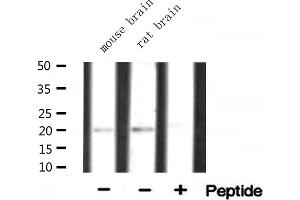 Western blot analysis of extracts of various tissue ,using RPL15 antibody