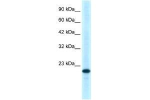 WB Suggested Anti-TNFRSF18 Antibody Titration:  0. (TNFRSF18 antibody  (C-Term))