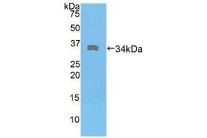 Western blot analysis of recombinant Human DMD. (Dystrophin antibody  (AA 3048-3328))