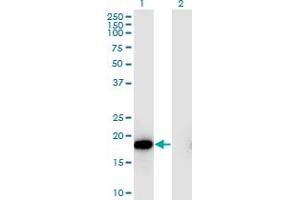 Western Blot analysis of HSPB6 expression in transfected 293T cell line by HSPB6 monoclonal antibody (M03), clone 6A4. (HSPB6 antibody  (AA 1-160))
