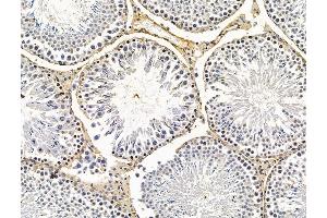 ABIN7096183 and ABIN7100245 at 1/100 staining rat testis tissue by IHC-P. (FAM181A antibody)