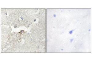 Immunohistochemistry (IHC) image for anti-Lemur tyrosine Kinase 2 (LMTK2) (Internal Region) antibody (ABIN1849762) (LMTK2 antibody  (Internal Region))