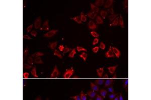 Immunofluorescence analysis of A549 cells using LIMS1 Polyclonal Antibody (LIMS1 antibody)
