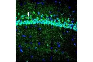 Immunohistochemistry (IHC) image for anti-Solute Carrier Family 39 (Zinc Transporter), Member 3 (SLC39A3) (AA 31-42), (Extracellular) antibody (ABIN7043724)