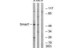 Western blot analysis of extracts from JK and K562 cells, using Smad1 (Ab-187) antibody. (SMAD1 antibody  (Ser187))