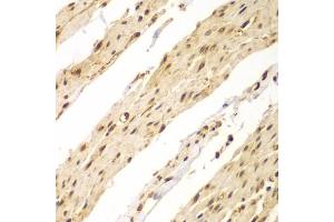 Immunohistochemistry of paraffin-embedded human colon using CDX1 antibody (ABIN2561793) at dilution of 1:100 (40x lens). (CDX1 antibody)