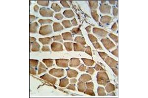 AP17920PU-N CARD4 antibody staining of Formalin-Fixed, Paraffin-Embedded Human skeletal muscle tissue. (NOD1 antibody  (C-Term))