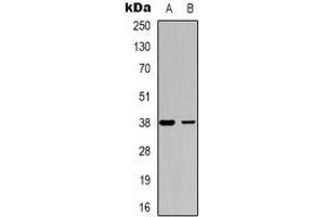 Western blot analysis of DOK6 expression in SHSY5Y (A), COLO205 (B) whole cell lysates. (DOK6 antibody)