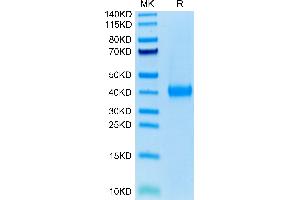 Human JAML on Tris-Bis PAGE under reduced condition.