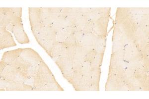 Detection of MSLN in Human Skeletal muscle Tissue using Monoclonal Antibody to Mesothelin (MSLN) (Mesothelin antibody  (AA 296-606))