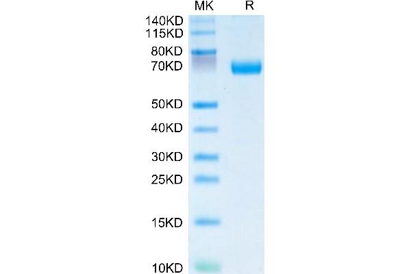 IL20RA Protein (AA 30-250) (Fc Tag)