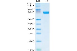 Human IL-20RA on Tris-Bis PAGE under reduced condition. (IL20RA Protein (AA 30-250) (Fc Tag))