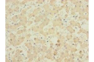 Immunohistochemistry of paraffin-embedded human liver tissue using ABIN7160690 at dilution of 1:100 (PIGL antibody  (AA 23-252))