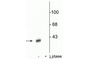 Western blot of rat striatal lysate showing specific immunolabeling of the ~32 kDa DARPP-32 phosphorylated at Thr34 in the first lane (-).
