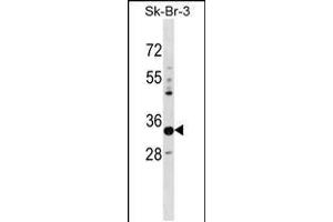 Western blot analysis in SK-BR-3 cell line lysates (35ug/lane). (PHYHD1 antibody  (C-Term))