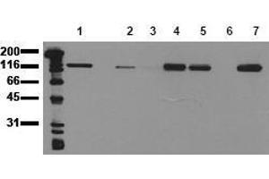Western Blotting (WB) image for anti-Cadherin 1, Type 1, E-Cadherin (Epithelial) (CDH1) antibody (ABIN126734) (E-cadherin antibody)