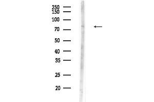anti-CNKSR Family Member 3 (CNKSR3) (N-Term) antibody