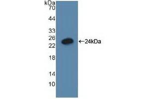 Detection of Recombinant GADD45a, Human using Polyclonal Antibody to Growth Arrest And DNA Damage Inducible Protein Alpha (GADD45a) (GADD45A antibody  (AA 1-165))