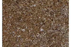 ABIN6278249 at 1/100 staining Mouse spleen tissue by IHC-P. (TRAM2 antibody  (C-Term))