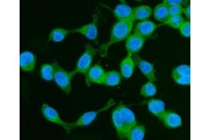 IF analysis of Drebrin/DBN1 using anti-Drebrin/DBN1 antibody (ABIN7602638). (DBN1 antibody  (AA 9-649))