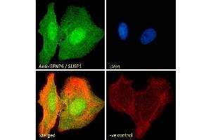 (ABIN334488) Immunofluorescence analysis of paraformaldehyde fixed U2OS cells, permeabilized with 0. (SENP6 antibody  (Internal Region))