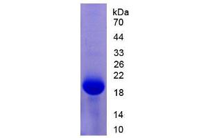 SDS-PAGE (SDS) image for Pim-1 Oncogene (PIM1) (AA 122-261) protein (His tag) (ABIN1171114)