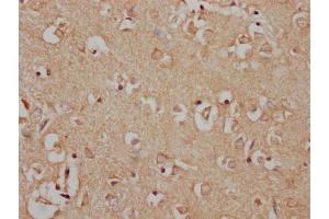 IHC image of nphHU diluted at 1:100 and staining in paraffin-embedded human brain tissue performed on a Leica BondTM system. (MAP3K7 antibody  (AA 179-194))