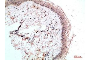 Immunohistochemical analysis of paraffin-embedded human-skin, antibody was diluted at 1:200 (RCC1 antibody  (AA 301-350))