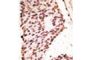 Image no. 2 for anti-Matrix Metallopeptidase 7 (Matrilysin, Uterine) (MMP7) (Middle Region) antibody (ABIN358701)