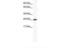 Image no. 1 for anti-Distal-Less Homeobox 4 (DLX4) (AA 57-106) antibody (ABIN202108) (DLX4 antibody  (AA 57-106))