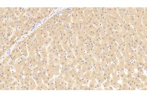 Detection of THRb in Human Liver Tissue using Polyclonal Antibody to Thyroid Hormone Receptor Beta (THRb) (THRB antibody  (AA 239-457))