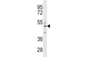 CD14 antibody western blot analysis in A549 lysate. (CD14 antibody  (AA 292-322))