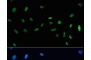 Immunofluorescence analysis of U-2 OS cells using SAFB Polyclonal Antibody at dilution of 1:100. (SAFB antibody)