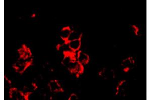 Frozen human synovial tissue section was stained with Mouse Anti-Human CD8-BIOT, IL-17F and their receptors in synovium of rheumatoid arthritis, psoriatic arthritis and osteoarthritis: possible explanation for nonresponse to anti-IL-17 therapy? (CD8 antibody  (Biotin))