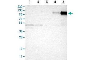 Western Blot analysis of Lane 1: RT-4 cell, Lane 2: U-251 MG sp cell, Lane 3: human plasma tissue (IgG/HSA depleted), Lane 4: human liver tissue and Lane 5: human tonsil tissue lysates with ITGB2 polyclonal antibody . (Integrin beta 2 antibody)