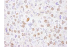 Immunohistochemistry (IHC) image for anti-Myocyte Enhancer Factor 2A (MEF2A) (AA 175-225) antibody (ABIN7454560) (MEF2A antibody  (AA 175-225))