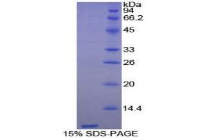 SDS-PAGE (SDS) image for Trefoil Factor 3 (Intestinal) (TFF3) (AA 24-80) protein (His tag) (ABIN1099550)