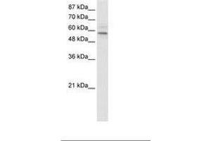 Image no. 1 for anti-Transmembrane Protein 175 (TMEM175) (AA 34-83) antibody (ABIN202675) (TMEM175 antibody  (AA 34-83))