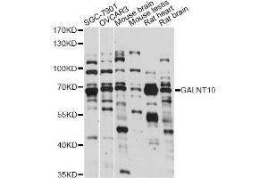 Western blot analysis of extracts of various cell lines, using GALNT10 antibody (ABIN6293992) at 1:1000 dilution.