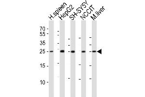 Western blot analysis of lysates from human spleen tissue lysate, HepG2, SH-SY5Y, NCCIT cell line, mouse liver tissue lysate (from left to right), using MIXL1 Antibody (C-term) (ABIN6243884 and ABIN6577779). (MIXL1 antibody  (C-Term))