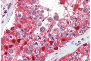 Testis, Human: Formalin-Fixed, Paraffin-Embedded (FFPE) (Ubiquitin antibody)