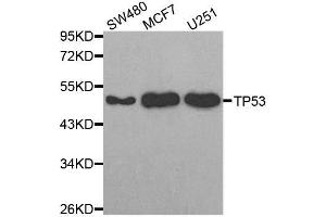 Western blot analysis of extracts of various cell lines, using TP53 antibody. (p53 antibody)