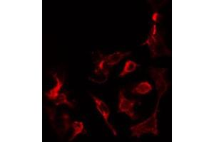 ABIN6274450 staining COLO205 cells by IF/ICC.
